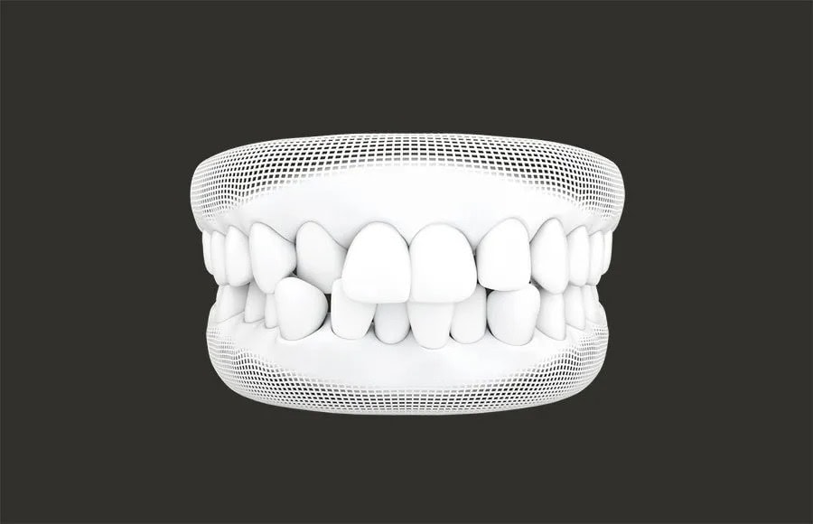 dental braces service Damansara uptown