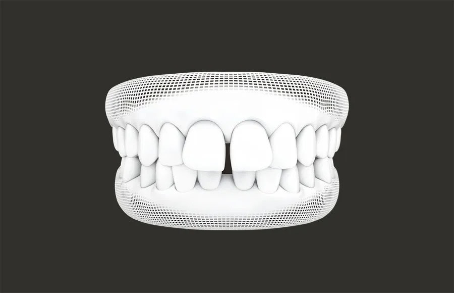 dental braces service Damansara uptown