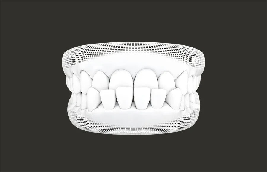 Invisalign Damansara uptown