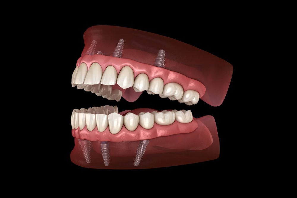 dentures service Damansara uptown