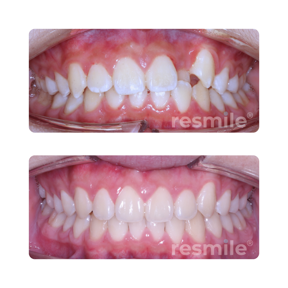 Invisalign Damansara uptown