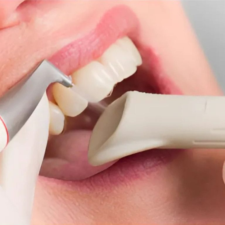 teeth scaling Damansara uptown