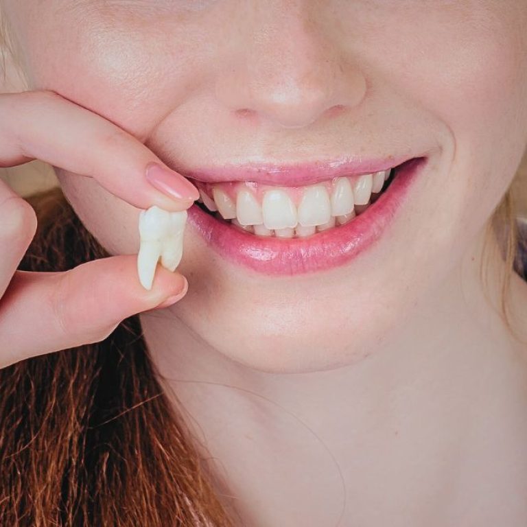wisdom-tooth-removal-img-1